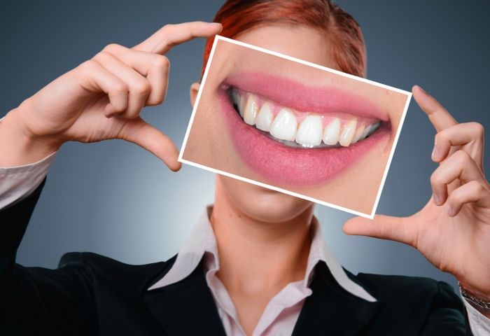 Teeth-Whitening Products Might Be Riskier Than We Thought