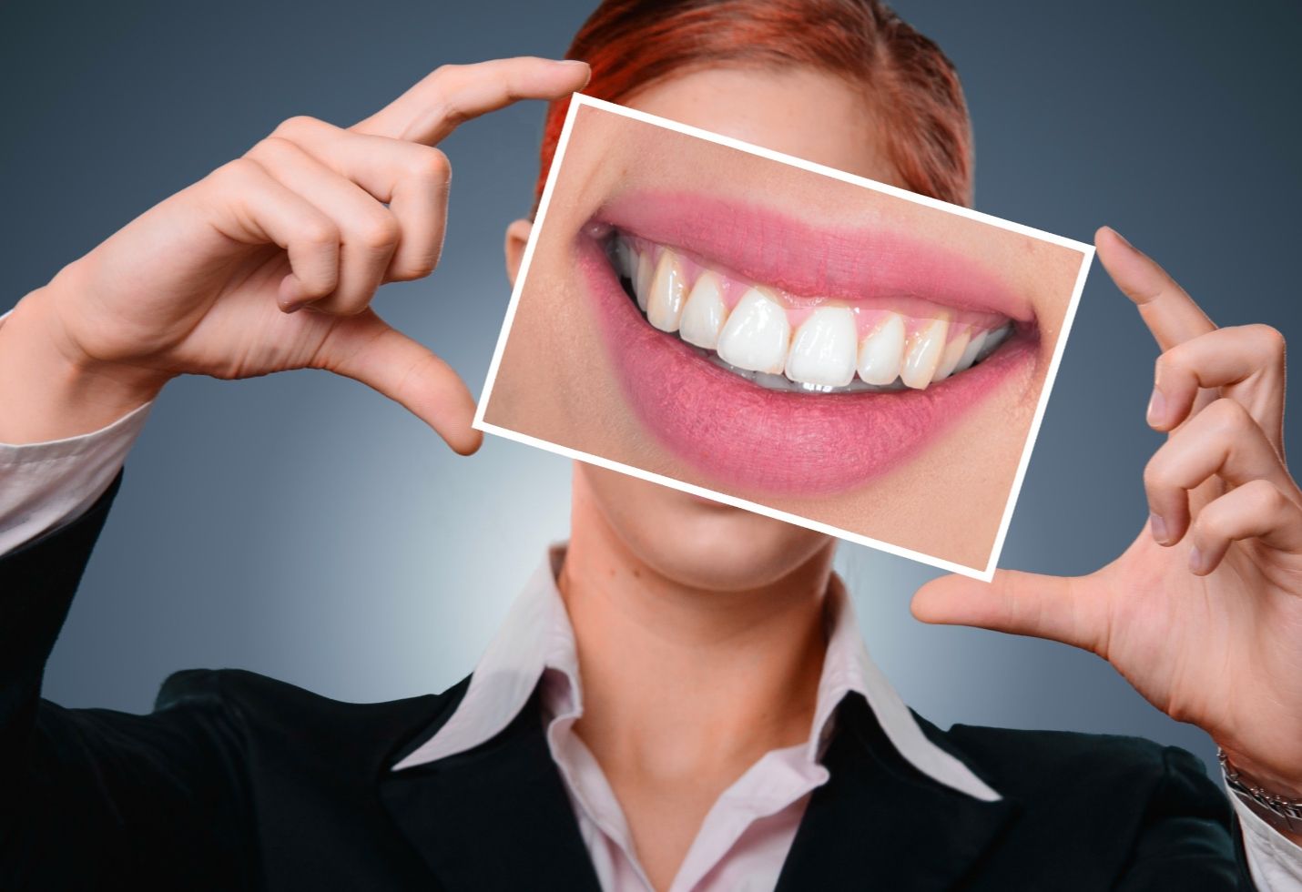 Teeth-Whitening Products Might Be Riskier Than We Thought