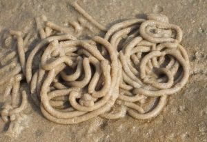 After Eight Days of Itchy Eyes, Oregon Woman Finds 14 Worms