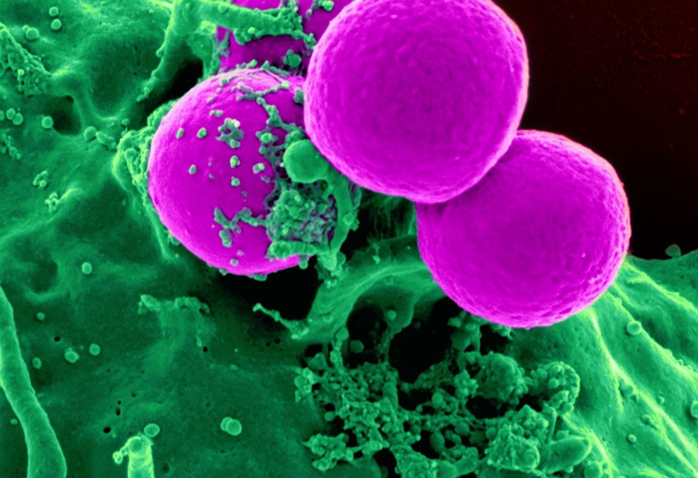 What's the difference between pandemic and epidemic?